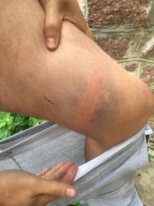Напад на активіста РУсанівські Сади
