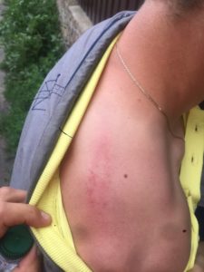 Напад на активіста РУсанівські Сади